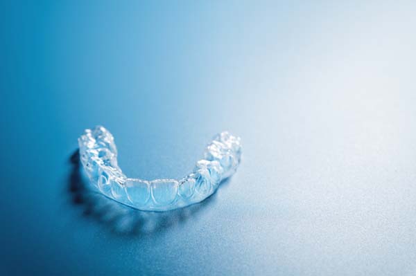 Why Clear Braces Are A Popular Option For Teeth Straightening