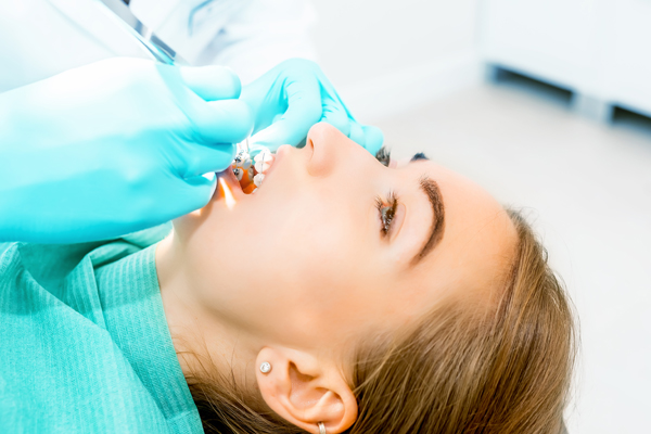How Long Does It Take For Clear Braces To Straighten Your Teeth?
