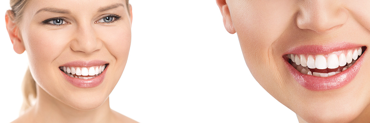 Burbank Cosmetic Dental Services