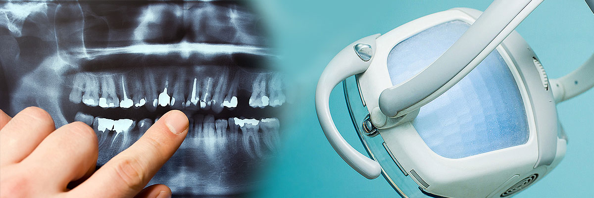 Burbank Dental Cleaning