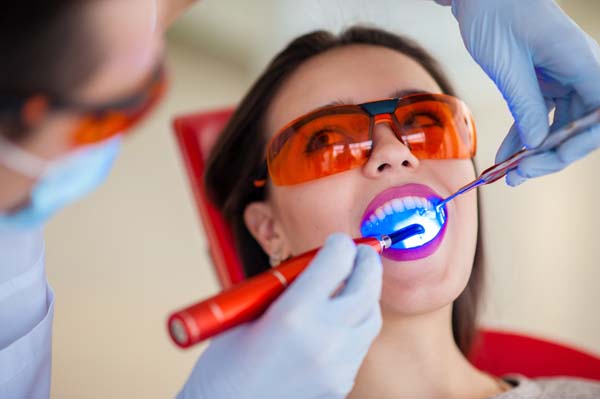 Why You Should Get Cavities Treated With Dental Fillings