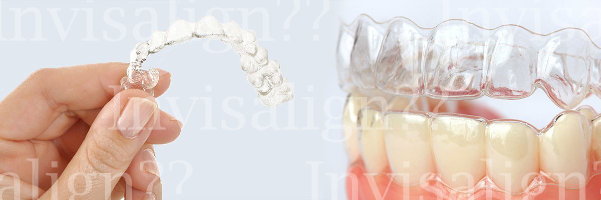 Burbank Does Invisalign® Really Work?
