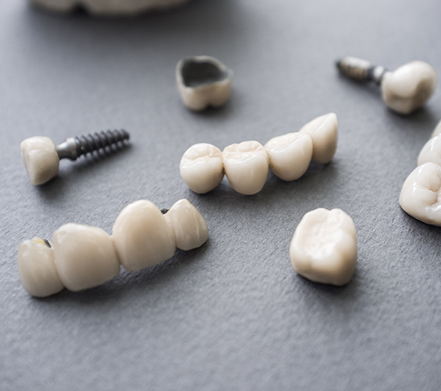 Burbank The Difference Between Dental Implants and Mini Dental Implants