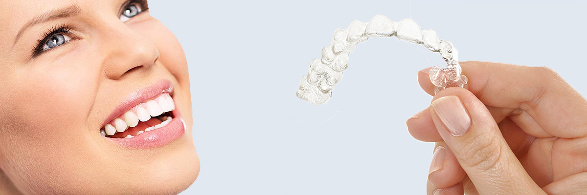 Burbank 7 Things Parents Need to Know About Invisalign Teen
