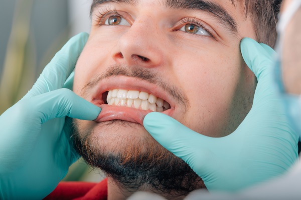 What To Expect At A Teeth Cleaning