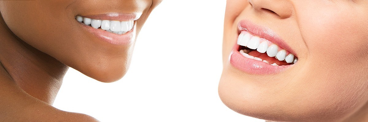 Burbank Teeth Whitening