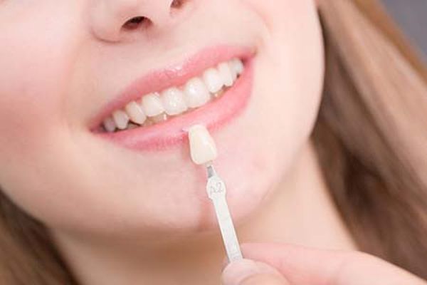 Does a Dental Veneer Treatment Damage Teeth? - Gables Exceptional