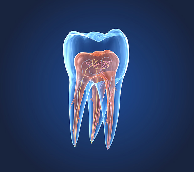 Burbank What is an Endodontist