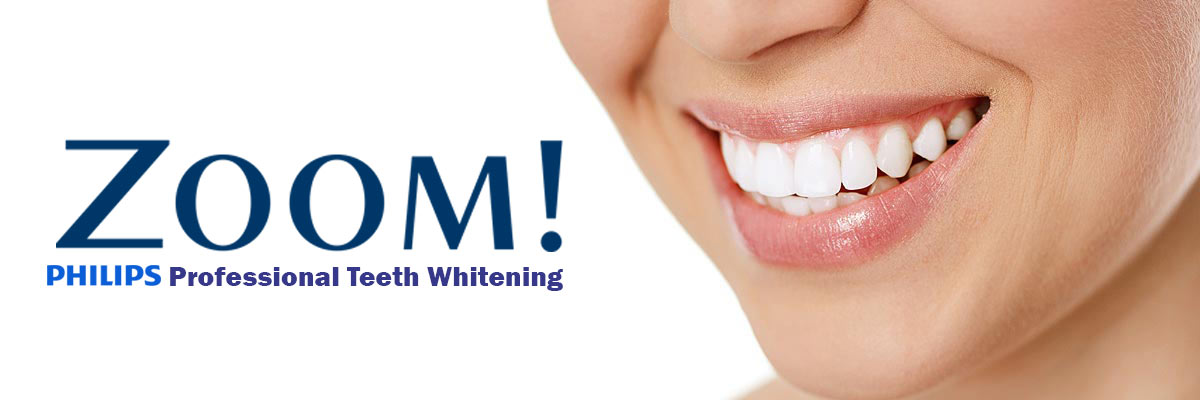 Burbank Zoom Teeth Whitening